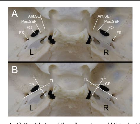 腰三角 構成|Visual Anatomy 視覚解剖学